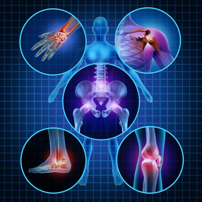 MEJORA LA SALUD DE TUS ARTICULACIONES: SUPLEMENTOS PARA MANTENER LA MOVILIDAD Y FUNCIONALIDAD ARTICULAR