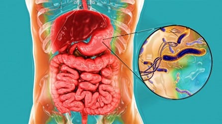 HELICOBACTER PYLORI: IMPACTO EN LA SALUD, DIAGNÓSTICO Y PAPEL DE LA NUTRICIÓN EN SU PREVENCIÓN Y TRATAMIENTO